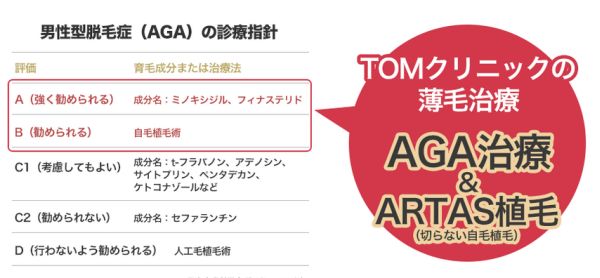 TOMクリニックの薄毛治療法 AGA治療とARTAS植毛